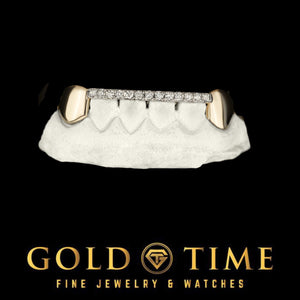 Yellow gold six piece grillz with solid canines and a moissanite tip bar seated on a cream dental model