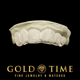 Silver 6 piece diamond dust grillz with a frosted hand cut texture, fitted to a dental mold