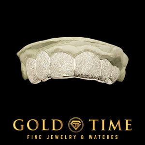 Silver 6 piece diamond dust grillz with a frosted hand cut texture, fitted to a dental mold