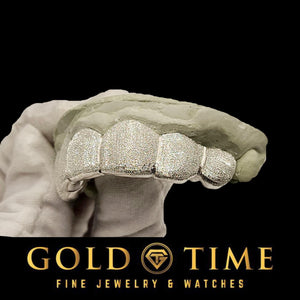 Silver diamond dust grillz held in a gloved hand on its dental mold
