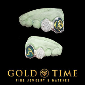 Two green dental models with embedded jewelry on a black background, featuring the Gold Time logo.