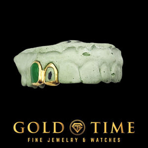 Angled view of the two piece jade tone grillz set fitted on a green dental model