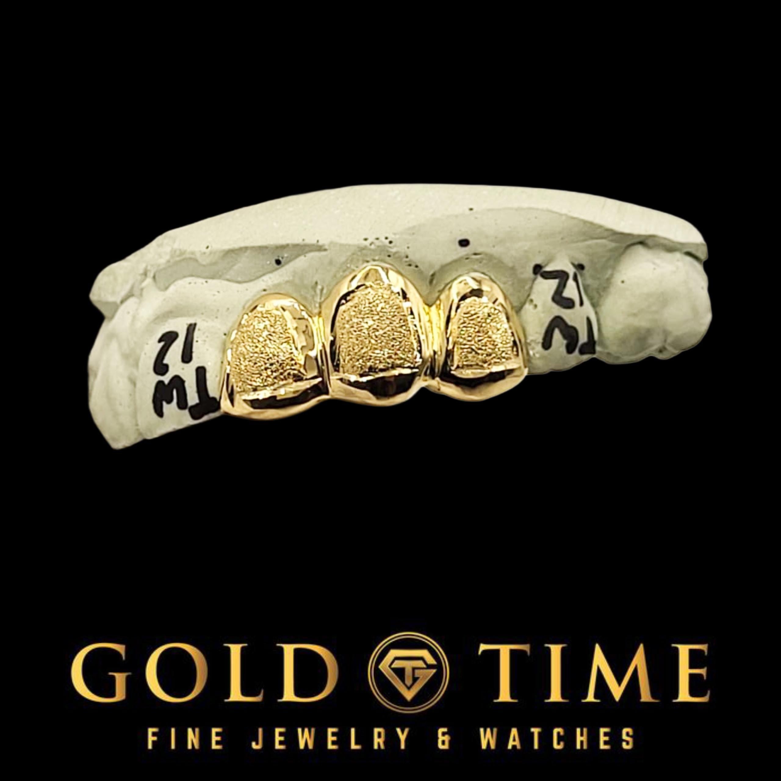 Custom Handmade Box Dust Triple Cap Grillz