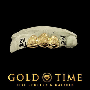 Gold dental grill on a black background with 'Gold Time' branding.