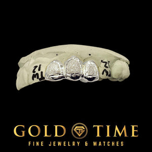 Gold grillz with diamonds on a black background with Gold Time logo.