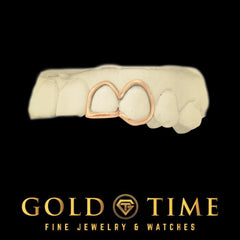 Custom 2-Piece Open Face Grillz with Impression Kit - Double Cap Minimalist Teeth Grill - Personalized Silver or Gold Grillz - Made to Order