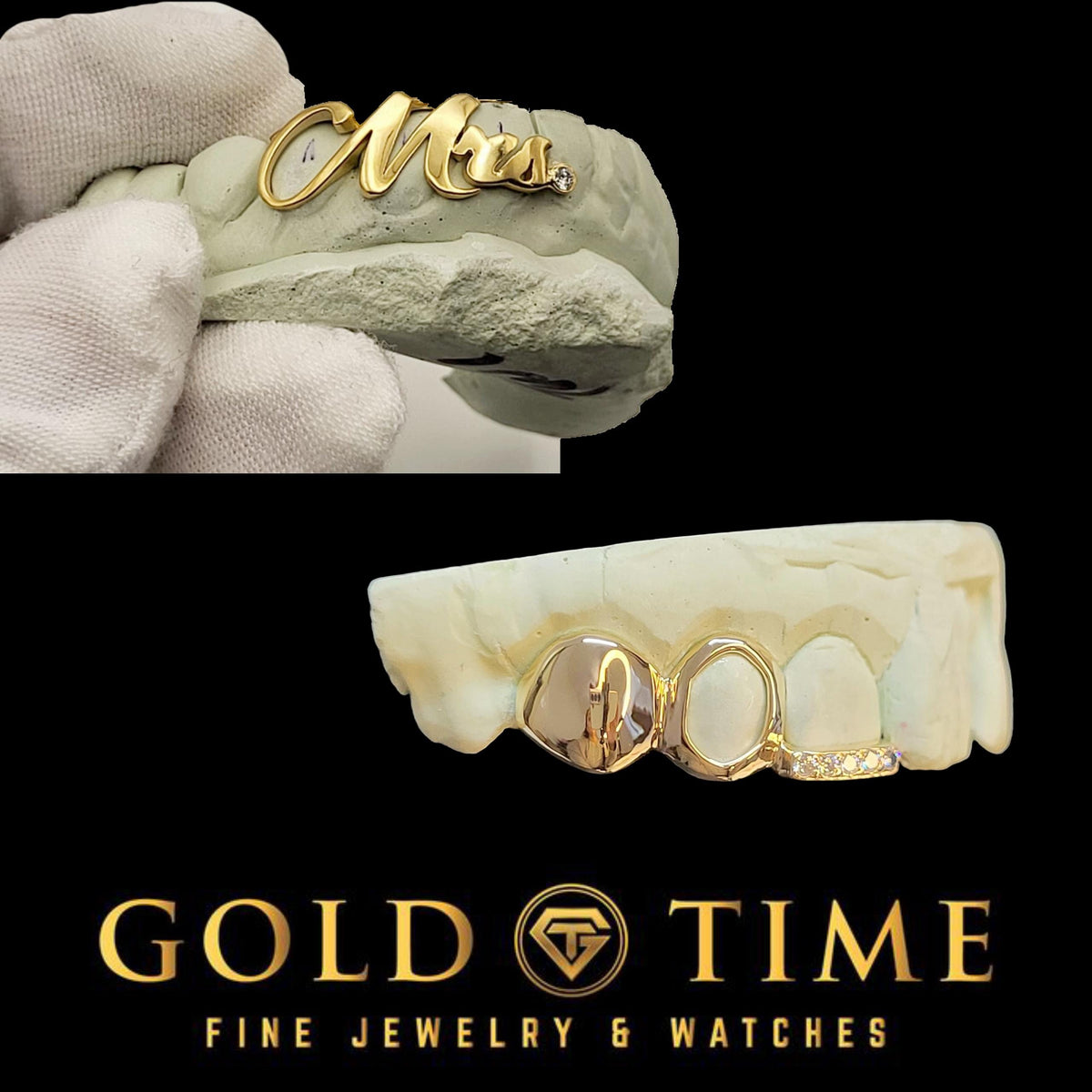 2 Silver Grillz - 3-Piece Triple Cap CZ Tip, Open Face, Solid, and 3 Piece Cursive Mrs. with Moissanite