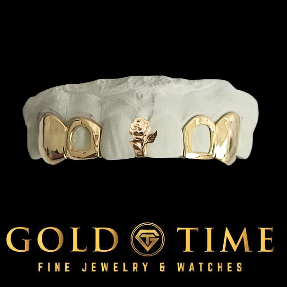 Custom Gold Grillz: Rose Gap, Open Face, Solid Canines - Impression Kit