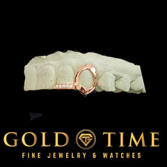 Custom Double Cap Moissanite Tip Fang Grillz: Open Face Canine, Incisor Tip