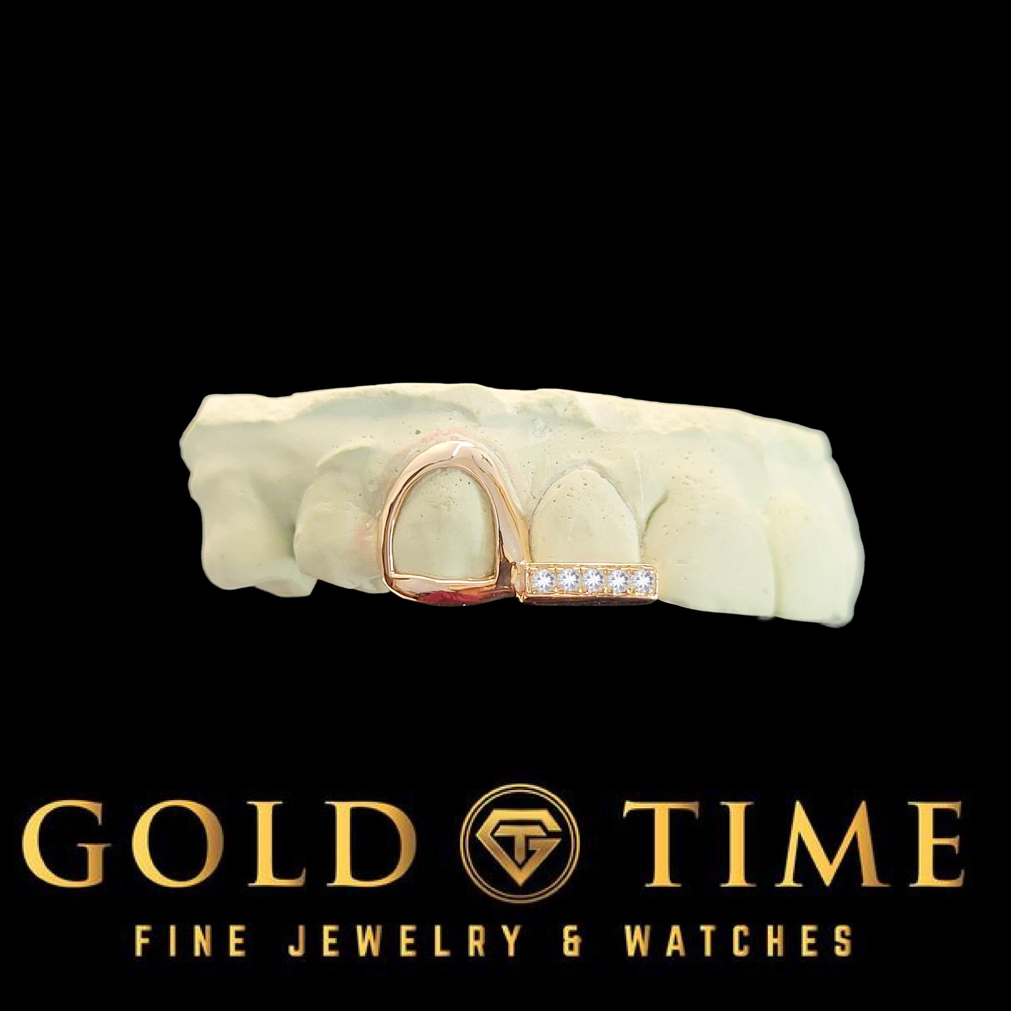 Custom Grillz: Open Face Canine & Moissanite Tip - Handmade Fit, Impression Kit