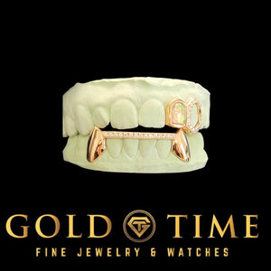 Rose gold opal and moissanite double cap on an upper dental mold, shown with a lower fang bar set, Gold Time