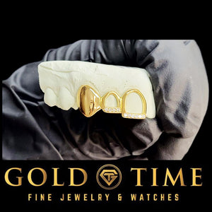 Custom yellow gold triple cap grillz with moissanite tips, angled view