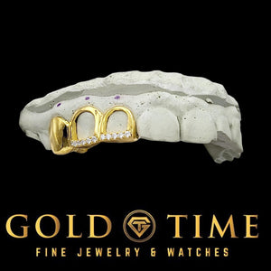 Side view of custom yellow gold triple cap grillz