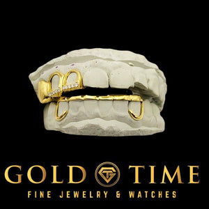 Custom yellow gold triple cap grillz on top teeth with an open face bottom piece
