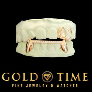 Custom rose gold bottom fang grillz with moissanite tip bar under an open face top cap