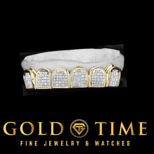 Six piece yellow CZ block grillz set on a white dental model, side angle