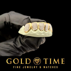 Gloved hand holding yellow gold box grillz with diamond dust faces