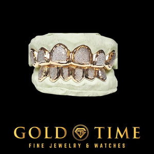 Rose gold diamond dust box grillz, top and bottom set with perm cuts