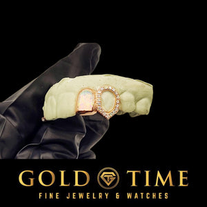 Rose gold opal and moissanite double cap grillz on a dental mold held in a gloved hand, Gold Time