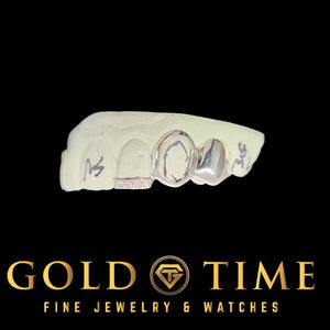 White gold 3 piece grillz with moissanite tip, open face cap, and solid cap on a dental mold
