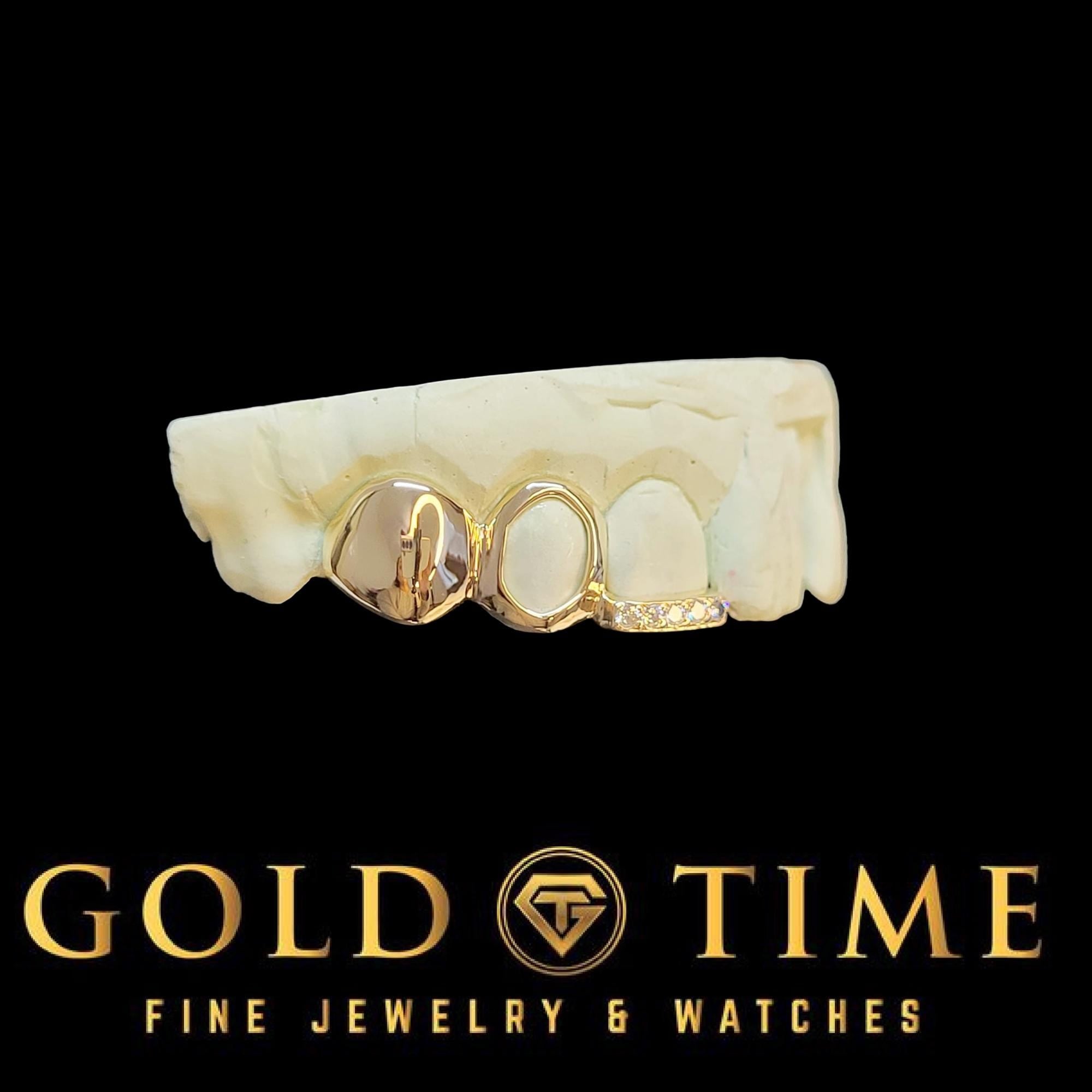 Custom 3-Piece Grillz Set: Solid, Open Face, Moissanite Tip - Includes Mold Kit