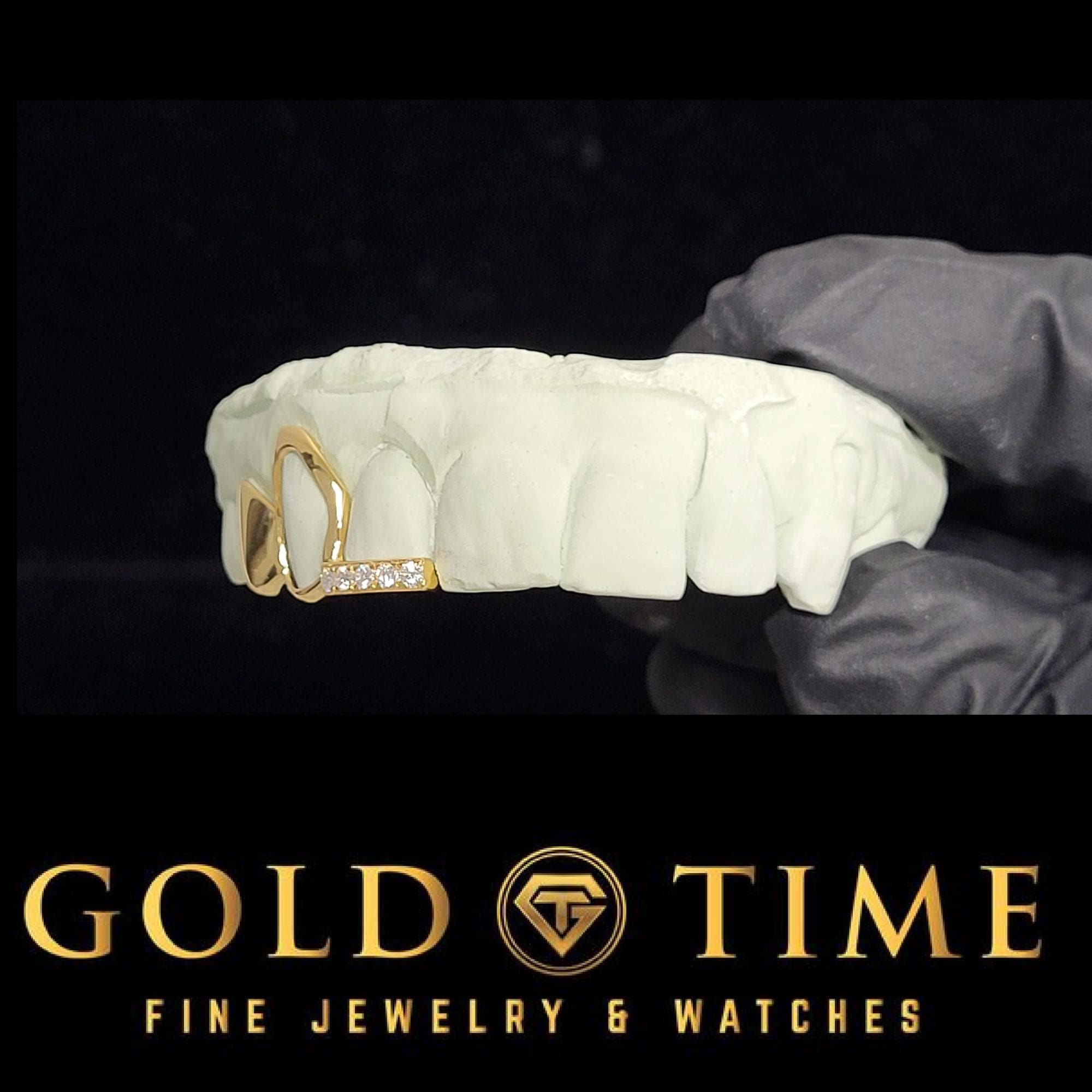 Custom 3-Piece Grillz Set: Solid, Open Face, Moissanite Tip - Includes Mold Kit