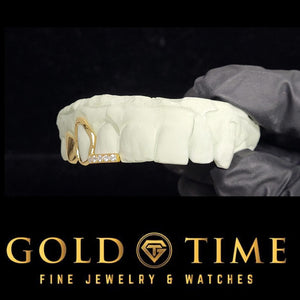 Yellow gold 3 piece grillz with an open face cap and moissanite tip bar on a dental mold held in a gloved hand