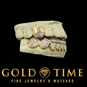 Angled view of two-tone gold grillz with solid top canine and textured trillion tip bottom caps