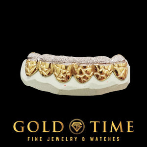 6 piece yellow gold nugget texture bottom grill with a white diamond dust edge on a dental mold