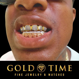 Man wearing the two-tone 12 piece diamond dust and nugget grillz set
