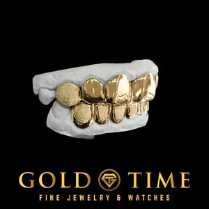 Yellow gold 12 piece diamond dust grillz set shown closed on the molds