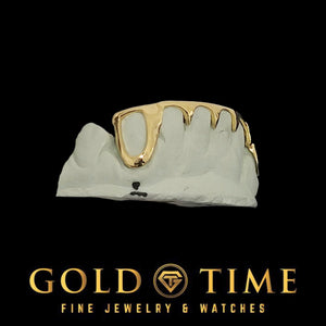Side angle of 6 piece gold bottom grillz with open face canines and spiked center tips