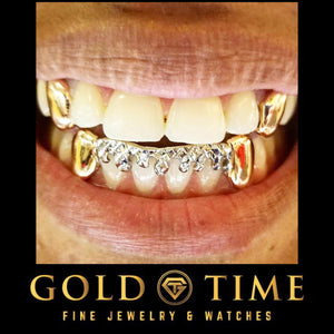 Two-tone drip grillz worn