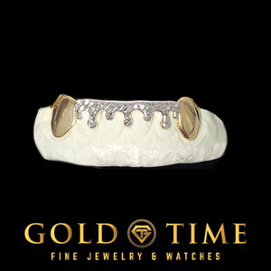 Front view of two-tone drip grillz on a mold