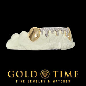 Side view of the two-tone drip grillz