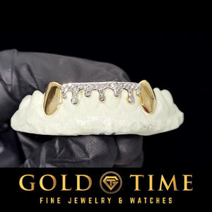 Two-tone drip grillz with polished yellow canines and a white diamond-cut drip on a mold