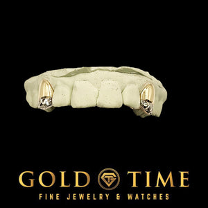 Custom 2 piece two-tone canine grillz, yellow caps with white trillion tips