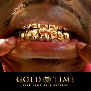 Close up of a customer showing yellow gold solid perm cut grillz on top and bottom teeth
