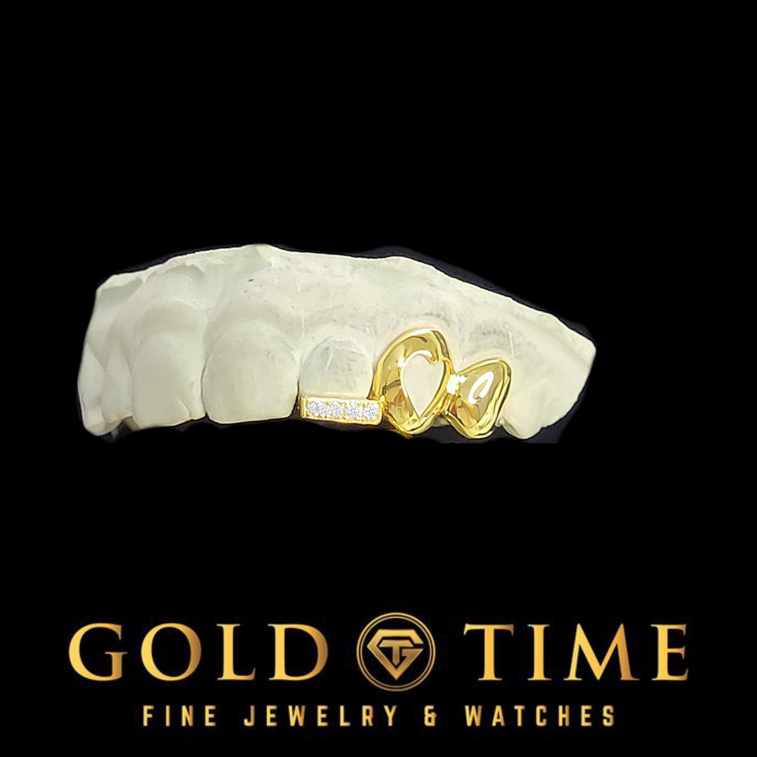 Custom 3-Piece Grillz Set: Solid, Heart Cut Out, Moissanite Tip - Includes Mold Kit