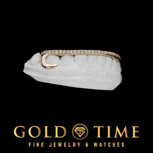 Side view of the moissanite tip hooks grill with the natural teeth left visible underneath