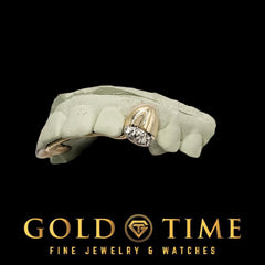 Custom 2-Piece Solid with Trillion Tip Canines  Two Tone Silver or Gold