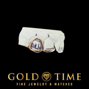 Two tone gold open face cap and solid incisor tip shown on a marked dental mold