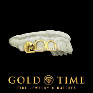 Custom yellow gold triple cap grillz, side angle