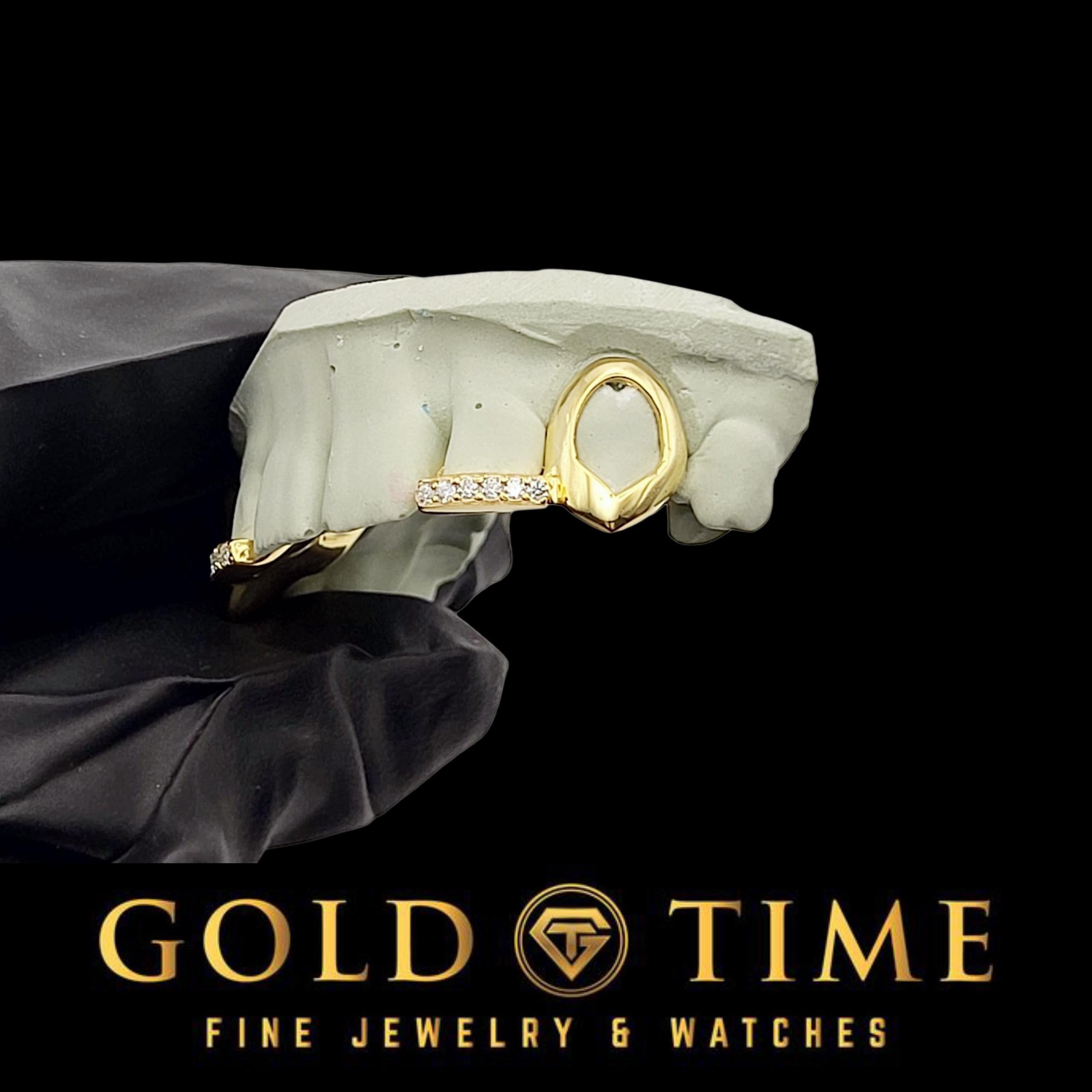 Custom 4-Piece Open Face Fangs with Custom Cut Out and Moissanite Incisor Tips