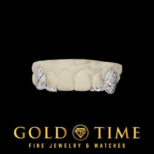 Close up of the diamond dust canine cap and trillion cut incisor tip side by side