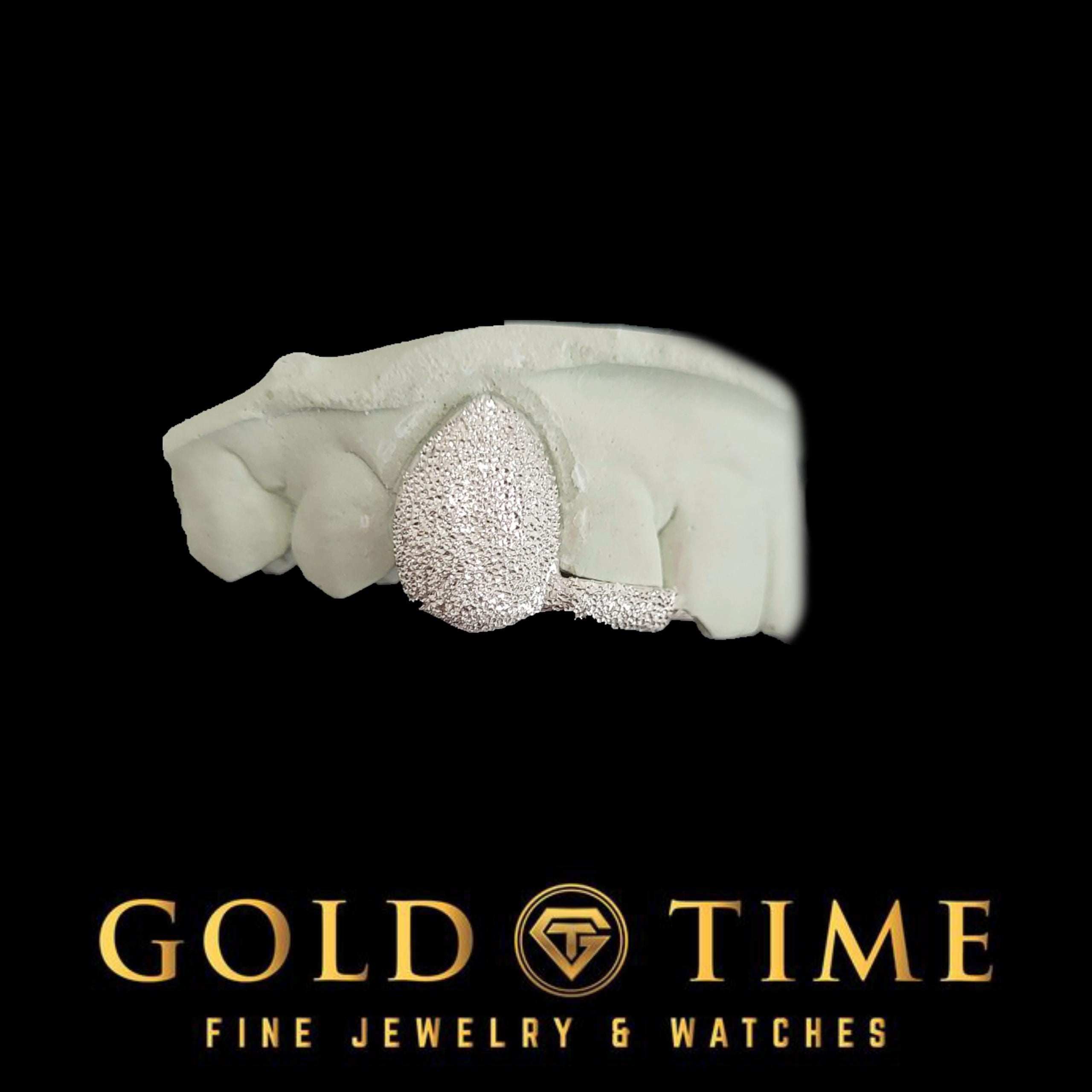 Custom Double Cap Grillz with Dust Canine & Dust Tip