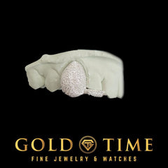 Custom Double Cap Grillz with Dust Canine & Dust Tip