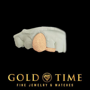 Rose gold double cap grill with a diamond dust canine cap and dust incisor tip on a top mold