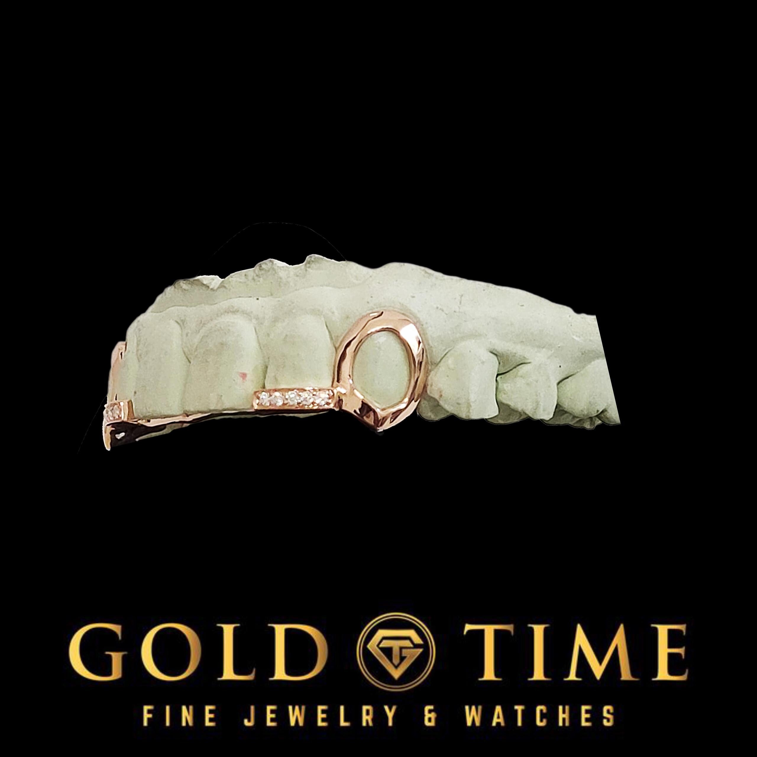 Custom 4-Piece Open Face Fangs with Moissanite Incisor Tips