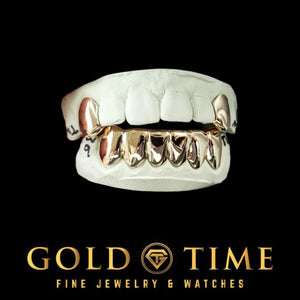Solid top canine and bottom six grillz set in a bright white finish on dental molds